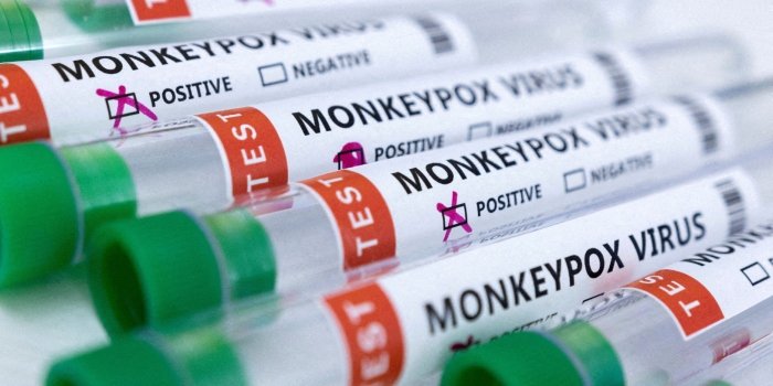 Monkeypox case reported in Pakistan