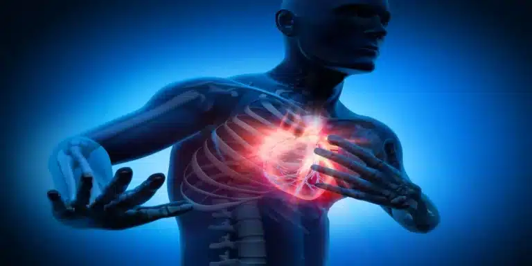 heart attack cases in Pakistan