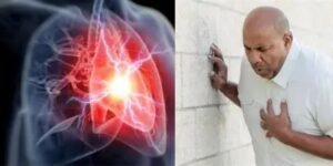 Heart diseases