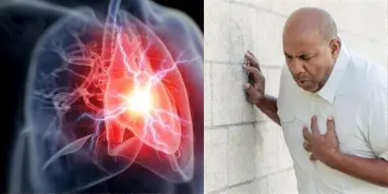 Heart diseases