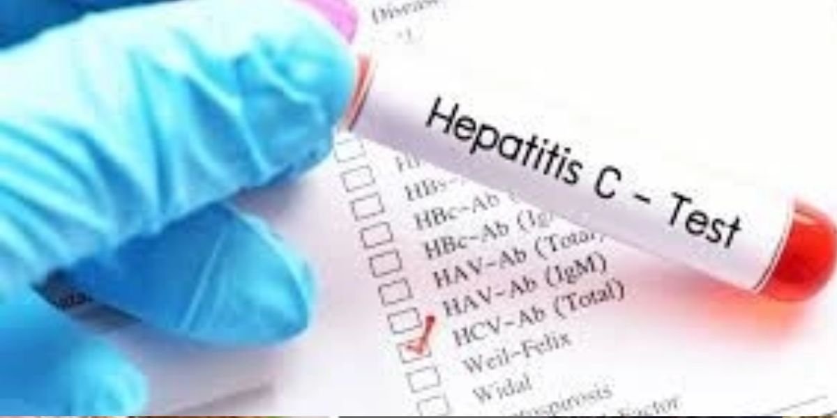 Pakistan to Screen 160 million people for hepatitis C