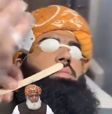 Madrassa funds? Fazlur Rehman’s son caught getting face touch ups at Islamabad’s expensive clinic